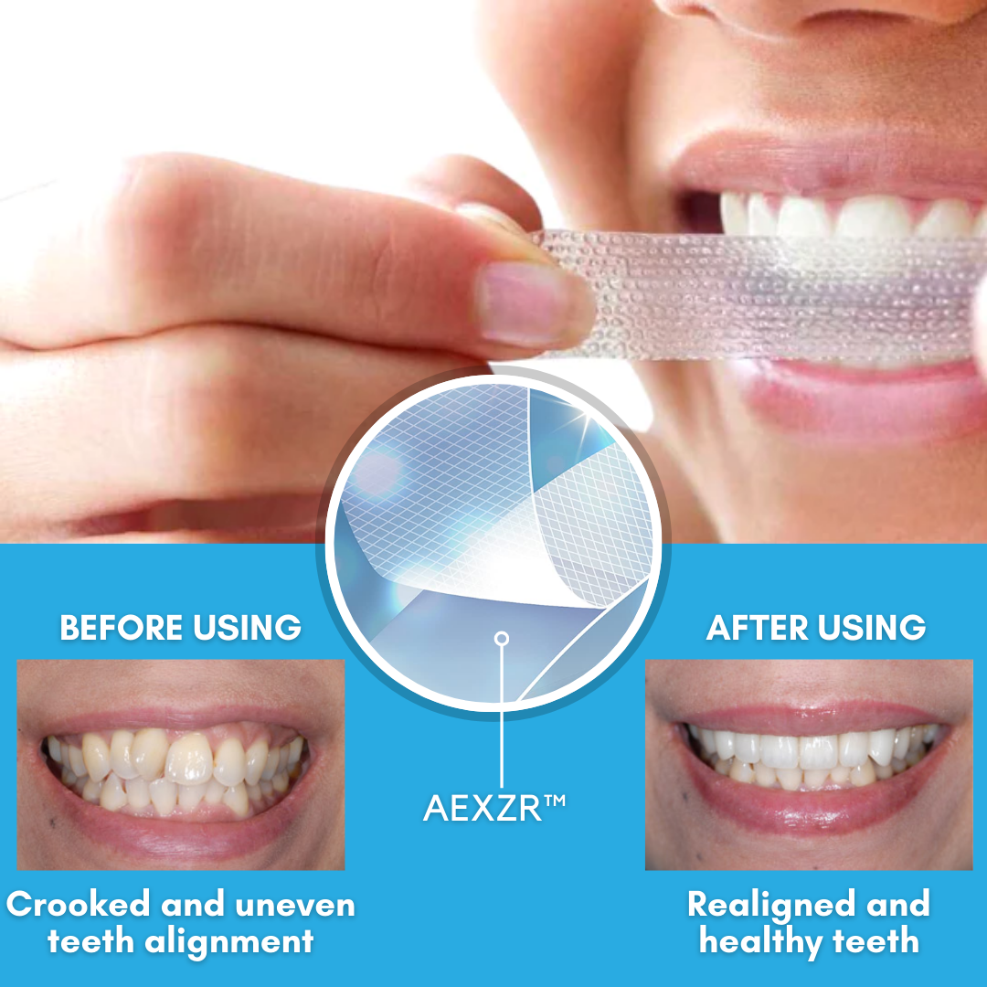 AEXZR™ Teeth Aligner Strips