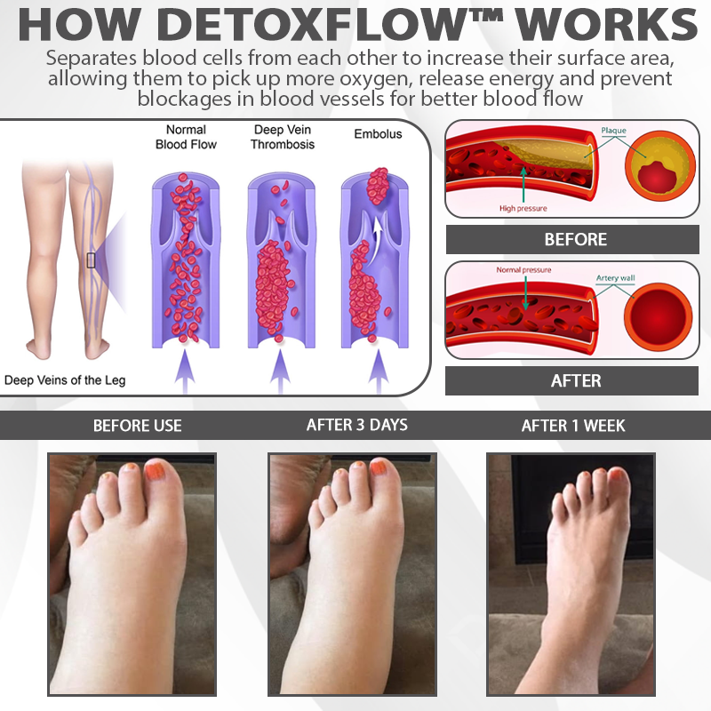 DetoxFlow™ EdemaRelief Lymphatic Detox Cream