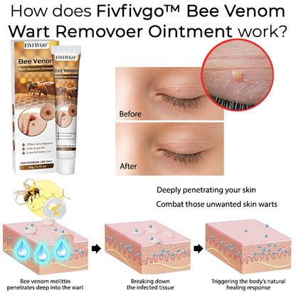 Oveallgo™ Bee Venom Wart Remover Ointment